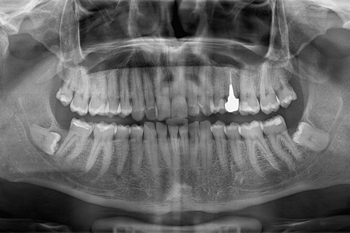 Cirurgia Oral