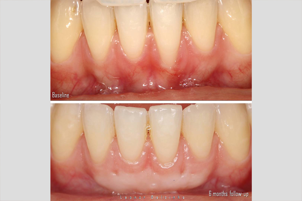 Periodontologia